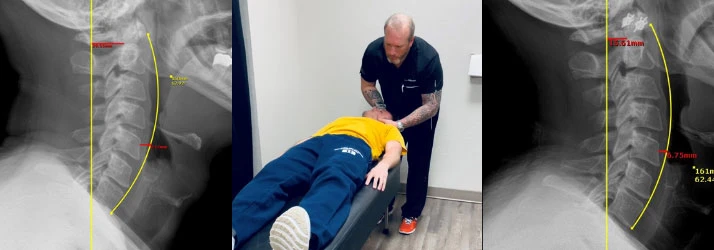 You Need Chiropractic: Why Your Posture Matters in Edmond OK